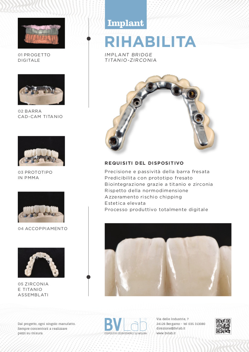 BV Lab produzione dispositivi odontoiatrici su misura da scansioni intraorali
