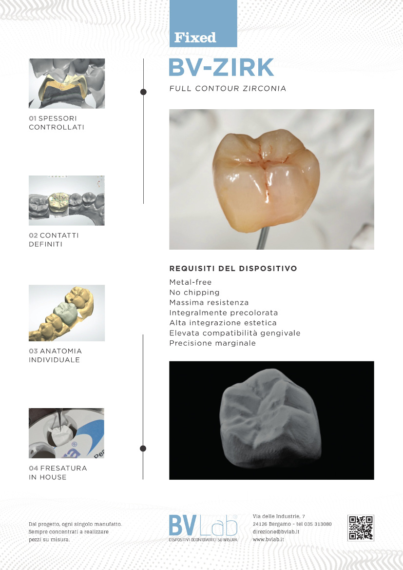 BV Lab produzione dispositivi odontoiatrici su misura da scansioni intraorali