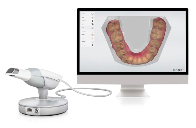 BV Lab produzione dispositivi odontoiatrici su misura da scansioni intraorali